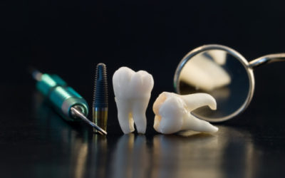 Οδοντική Χειρουργική